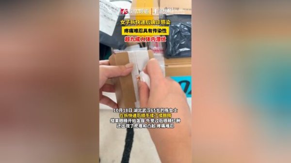 j9九游会真人许多东说念主皆会迫不足待地径直用手将包装袋撕开-九游会·(j9)官方网站